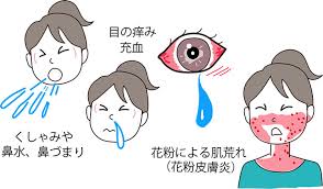 体験者の声